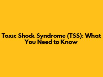 Toxic Shock Syndrome (TSS): What You Need to Know